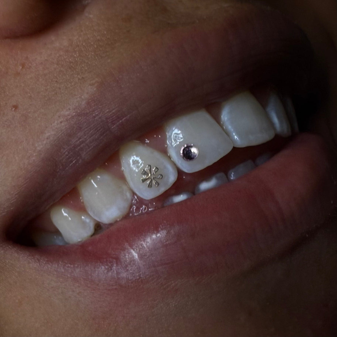 Tooth Gem Aftercare: How to Look After Your Tooth Gem