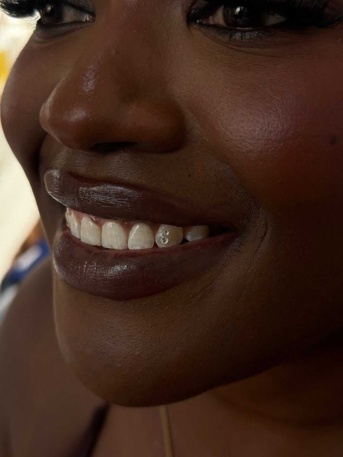 How Long Do Tooth Gems Last?